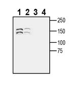 SEZ6 (extracellular) Antibody in Western Blot (WB)