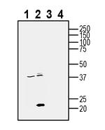 CD81 (extracellular) Antibody in Western Blot (WB)