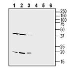 CD81 (extracellular) Antibody in Western Blot (WB)