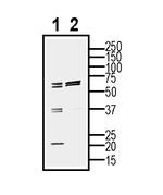 CD81 (extracellular) Antibody in Western Blot (WB)