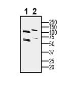 CD81 (extracellular) Antibody in Western Blot (WB)