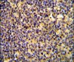 ANR44 Antibody in Immunohistochemistry (IHC)