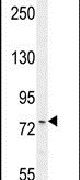 ANR44 Antibody in Western Blot (WB)