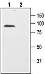 p75 NGF Receptor (extracellular) Antibody in Western Blot (WB)