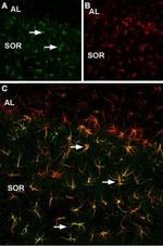p75 NGF Receptor (intracellular) Polyclonal Antibody