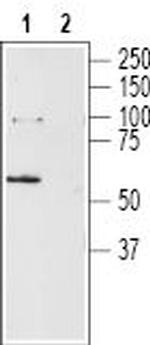 Neurotensin Receptor 2 Antibody in Western Blot (WB)