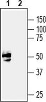 GFR alpha 3 (extracellular) Antibody in Western Blot (WB)