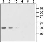 proGDNF Polyclonal Antibody