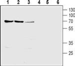 SLC28A1 (CNT1) Polyclonal Antibody