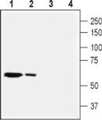 SLC28A2 (CNT2) Polyclonal Antibody
