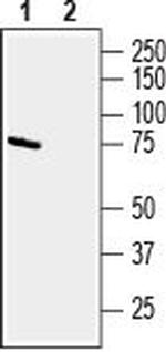 CD39 (extracellular) Antibody in Western Blot (WB)