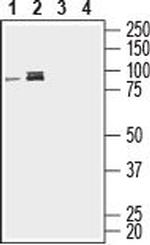 CD39 (extracellular) Polyclonal Antibody