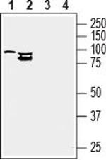 CD39 (extracellular) Antibody in Western Blot (WB)