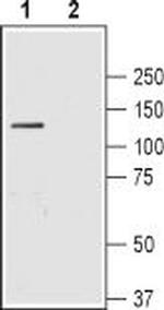 SLC4A4 (NBC1) (extracellular) Antibody in Western Blot (WB)