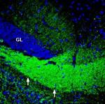 ASCT2 (SLC1A5) Polyclonal Antibody