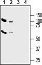 ASCT2 (SLC1A5) Antibody in Western Blot (WB)