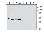 ASCT2/SLC1A5 (extracellular) Polyclonal Antibody