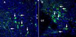 SLC17A9 Polyclonal Antibody