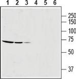 SLC25A12 Polyclonal Antibody