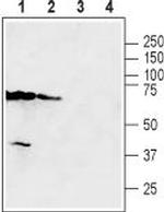 SLC47A2 Polyclonal Antibody