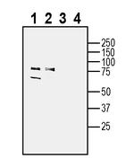 SLC38A2 (SNAT2) Antibody in Western Blot (WB)