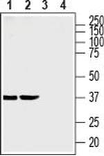SLC35G1 (extracellular) Polyclonal Antibody