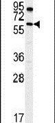 TEM8 Antibody in Western Blot (WB)