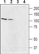 Na+/H+ Exchanger 5 (NHE-5) Polyclonal Antibody