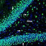 Na+/H+ Exchanger 6 (NHE-6) Polyclonal Antibody