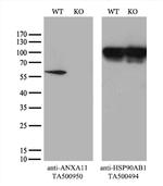 ANXA11 Antibody