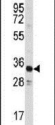 Annexin A3 Antibody in Western Blot (WB)