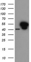 ANXA7 (Annexin VII) Antibody in Western Blot (WB)