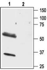 Orexin Receptor 1 Antibody in Western Blot (WB)