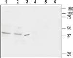 Nociceptin Receptor (OPRL1) Polyclonal Antibody