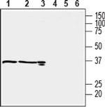 OXGR1/GPR99 Antibody in Western Blot (WB)