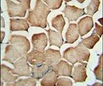 AP1S1 Antibody in Immunohistochemistry (IHC)