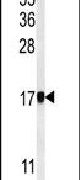 AP1S1 Antibody in Western Blot (WB)