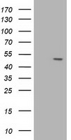 AP2M1 Antibody in Western Blot (WB)