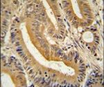 AP3S1 Antibody in Immunohistochemistry (IHC)