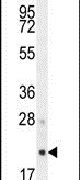 AP3S1 Antibody in Western Blot (WB)