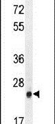 AP3S1 Antibody in Western Blot (WB)