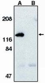 APAF1 Antibody in Western Blot (WB)