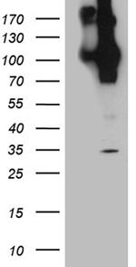 APBB1 Antibody in Western Blot (WB)