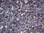 APBB1IP Antibody in Immunohistochemistry (Paraffin) (IHC (P))