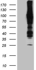 APBB1IP Antibody in Western Blot (WB)