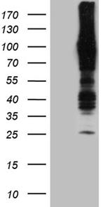 APBB1IP Antibody in Western Blot (WB)