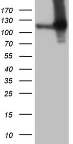 APBB1IP Antibody in Western Blot (WB)
