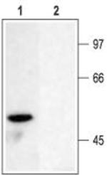KV1.6 (KCNA6) Polyclonal Antibody