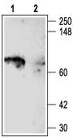 KV1.5 (KCNA5) Polyclonal Antibody