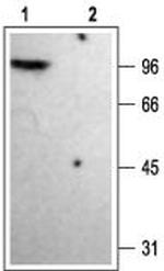 KV1.4 Polyclonal Antibody
